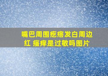 嘴巴周围疙瘩发白周边红 瘙痒是过敏吗图片